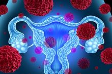 10～30岁女性：接种HPV疫苗可显著降低侵袭性宫颈癌风险