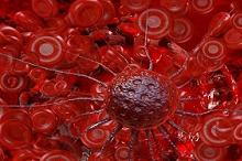 血液恶性肿瘤和HCT：艾沙康唑预防侵袭性真菌感染 不优于泊沙康唑与伏立康唑