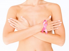 年轻女子左乳高级别导管原位癌术后11个月 右乳也未能幸免