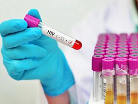 中国研究揭示合并和不合并HIV感染的隐球菌血症患者的临床特征和结局