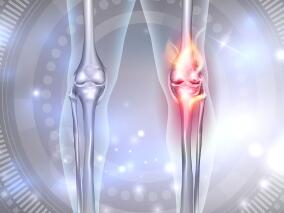 膝关节置换患者静脉血栓栓塞预防：阿司匹林vs阿哌沙班
