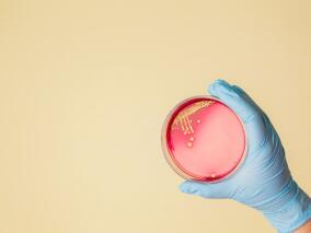 注射毒品相关细菌和真菌感染住院后 OAT与较低的死亡和复发风险相关