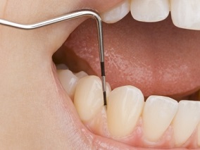 拔牙能诱发心内膜炎 是危言耸听吗？最新研究结果来了