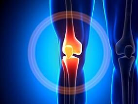 膝关节置换术患者关节周围麻醉剂：布比卡因脂质体和盐酸布比卡因vs仅盐酸布比卡因