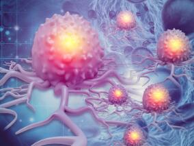 复发性EB病毒阳性淋巴系统恶性肿瘤 nanatinostat靶向治疗联合缬更昔洛韦的有效性