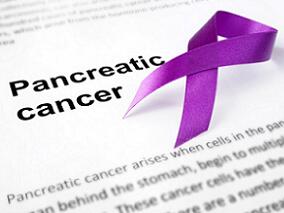 美国癌症研究协会2024年会报道：一种液体活检检测技术检测早期胰腺癌的准确率或达97%