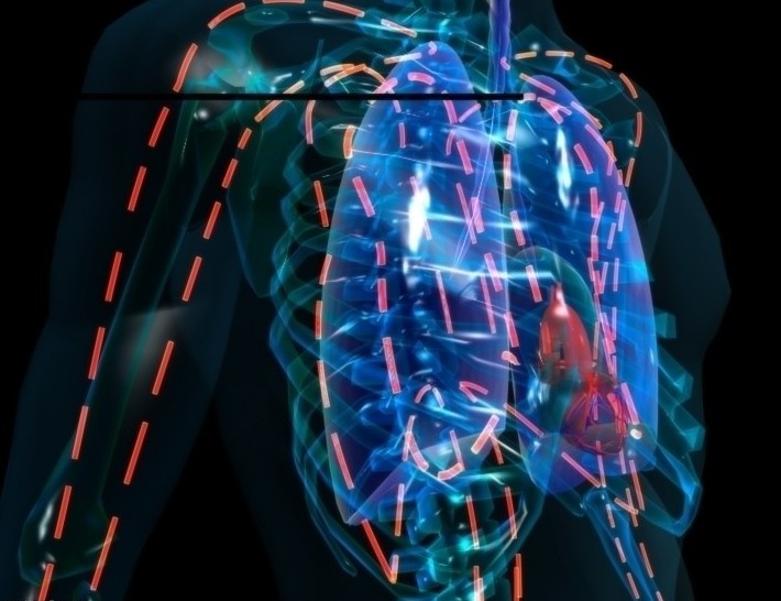 儿基会呼吁干预儿童肺炎与腹泻