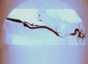 静注人免疫球蛋白在儿科应用