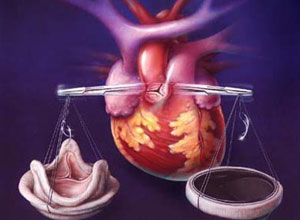 静注人免疫球蛋白在血液科的使用