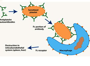 静注人免疫球蛋白在神经科应用