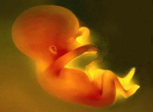 他汀类药物的致畸风险仍不明确（Ann Pharmacother. 2012 Oct;46(10):1419-24）