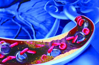 负荷剂量阿司匹林为急性缺血性脑卒中患者早期血小板抑制作用的有益选择(Thromb Haemost. 2012 Jan)