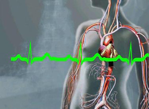 心肌梗塞患者进行心脏康复治疗建议