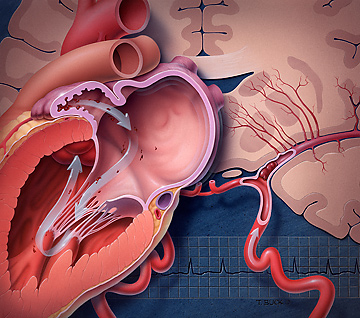 华法林目标剂量的变异性与用药依从性的关系(Pharmacogenomics. 2013 Jan;14(2):151-63.)