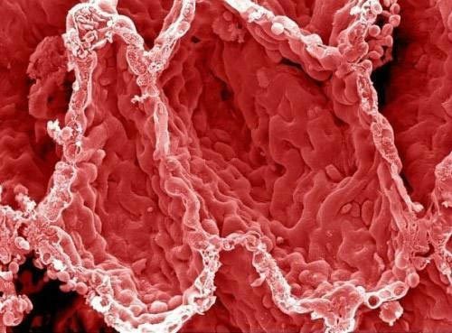 噻托溴铵用于控制不佳的持续性哮喘患者（Ann Pharmacother. 2013 Jan;47(1):117-23.）