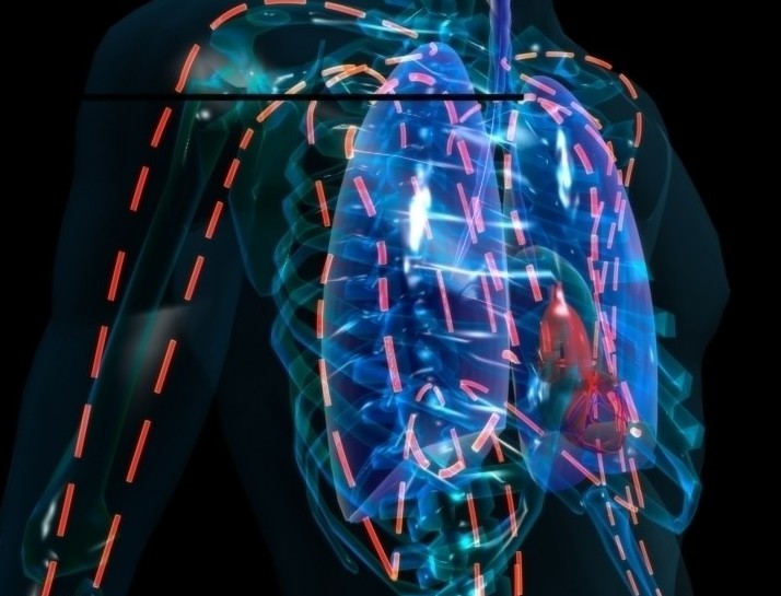 低血压休克患者大剂量升压药使用后的生存率（Chest. 2013 Mar 1;143(3):664-71. doi: 10.1378/chest.12-1106.）