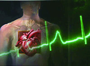 低剂量的阿托伐他汀能降低心血管风险吗？（Am J Hypertens. 2013 May 1）