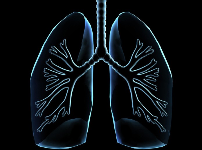 既往使用过吸入糖皮质激素的社区获得性肺炎患者出现胸腔积液的几率会下降？（Am J Respir Crit Care Med. 2013 Jun 1;187(11):1241-8.）