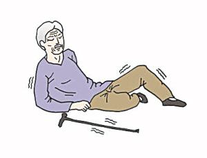 基于临床特征对跌倒风险进行分层或可指导临床护理工作