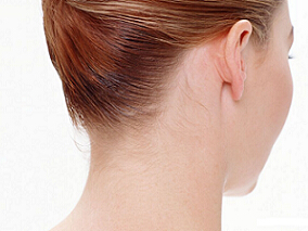 颈部脂肪堆积与心血管风险和代谢综合征相关