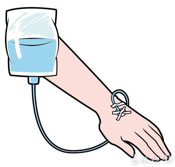 肠外营养和肠内营养在重症患者早期营养支持上同样有效