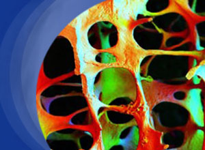 硼替佐米与沙利度胺可显著改善不适合接受移植的多发性骨髓瘤患者的总生存率