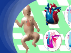 儿童哮喘急性加重：单次或两次地塞米松给药与泼尼松治疗5天一样有效