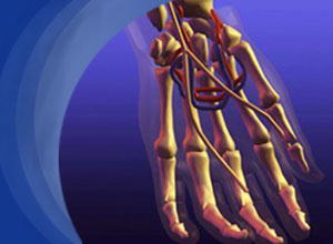 手和手腕脓毒性关节炎的抗菌药物治疗