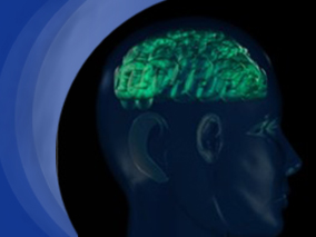 缺血性卒中后华法林相关的颅内出血风险较低