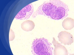 VRE菌血症治疗:达托霉素、利奈唑胺、β-内酰胺类同样有效