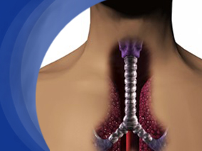 吸入糖皮质激素和长效β2激动剂治疗儿童和成人支气管扩张