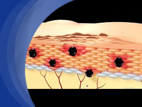 他汀与危重患者谵妄的相关性