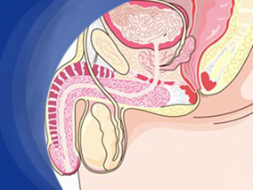 老年患者前列腺癌的治疗