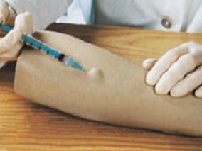 甲氨蝶呤在克罗恩病儿童患者中的给药途径：SC优于PO