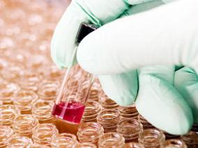 干血点/干血浆法可监测抗逆转录病毒治疗的效果