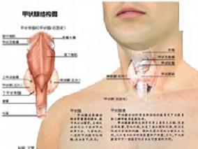 长期强化补碘如何影响甲状腺结构？