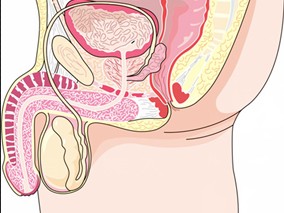 转移性前列腺癌患者每日服用阿司匹林与PCSM之间是否存在相关性?