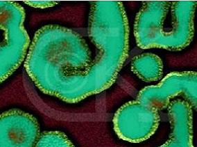 金刚烷胺和金刚乙胺治疗儿童及老年A型流感患者能否获益？