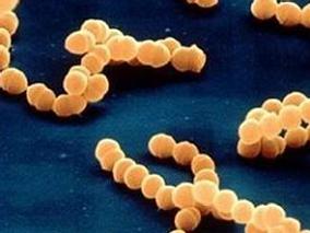 抗逆转录病毒治疗盛行时代非洲住院患者的脓毒症死亡率仍高居不下