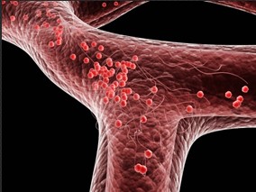 d-二聚体检测是否影响首次无诱因静脉血栓栓塞患者的复发风险?