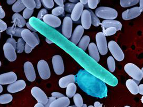 静脉给予甲硝唑联合口服万古霉素可改善CDI危重患者的死亡率