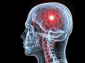 突发房颤的血液透析患者使用华法林或降低缺血性卒中风险