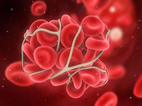 FCR3作为慢性淋巴细胞白血病一线疗法的安全性和有效性