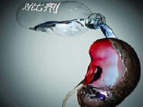 对比剂诱导的急性肾损伤：碘克沙醇优于碘海醇