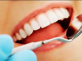 他汀或可缓解慢性牙周炎