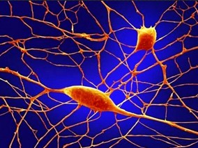 r-tPA联合依替巴肽治疗急性缺血性卒中的疗效如何？