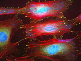 对乙酰氨基酚可减少严重脓毒症患者的氧化损伤