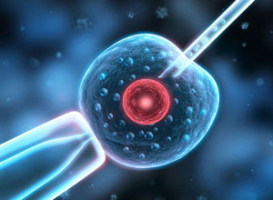 男性不育夫妇多胎妊娠的预防：体外受精vs宫腔内人工授精