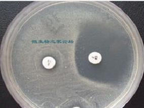 根除治疗后后续MRSA培养：3次培养足够吗？