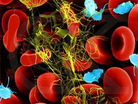 逆转维生素K拮抗剂抗凝：4因子凝血酶原复合物vs血浆